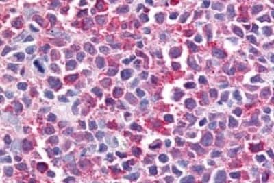 Immunohistochemistry-Paraffin: Bestrophin 2 Antibody [NBP3-14548]